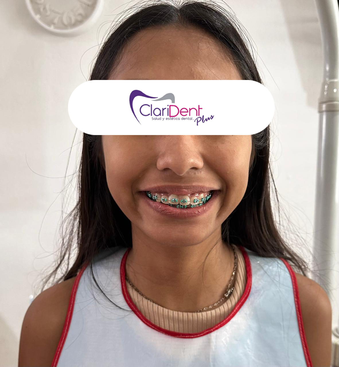 Brackets metálicos