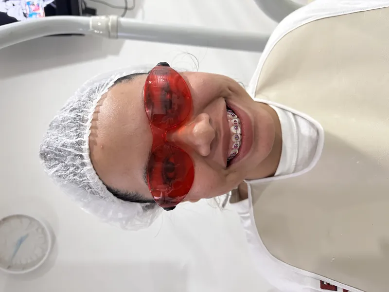 Brakets metálico